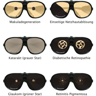 Simulationsbrillen zur Simulation von Augenerkrankungen